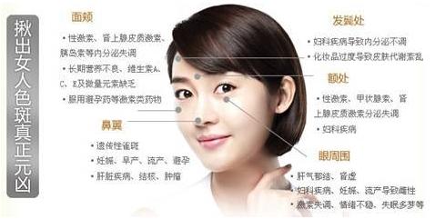 最新祛斑医美技术，科技与美丽的完美融合