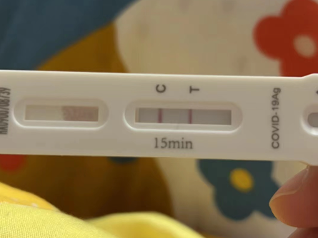 抗原阳性照片最新研究成果揭秘