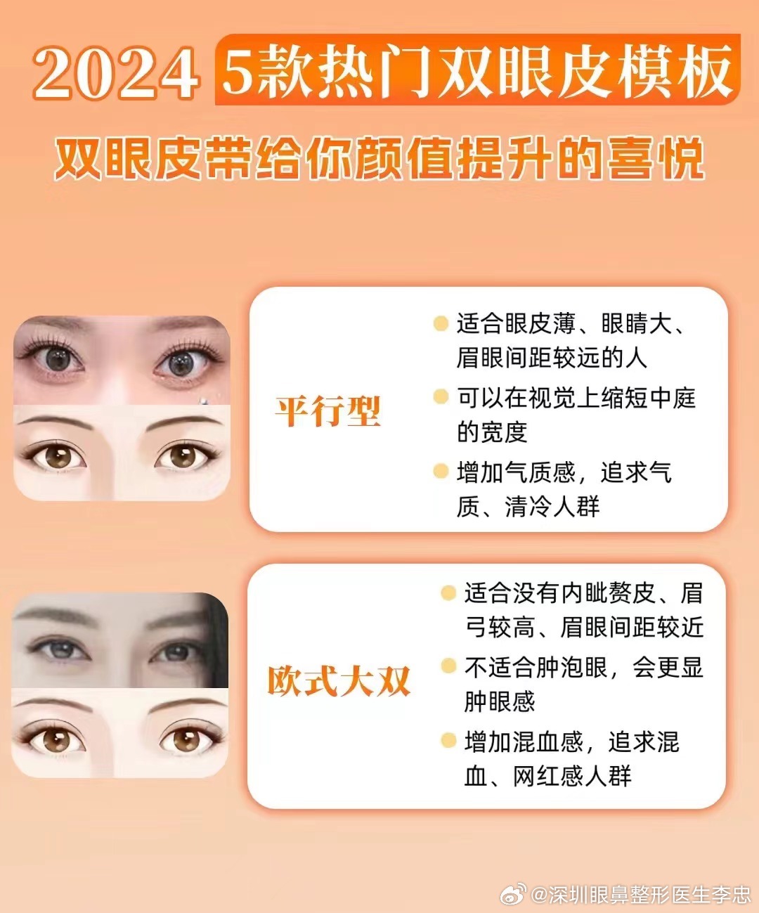 双眼皮魅力，最新流行趋势下的时尚之选
