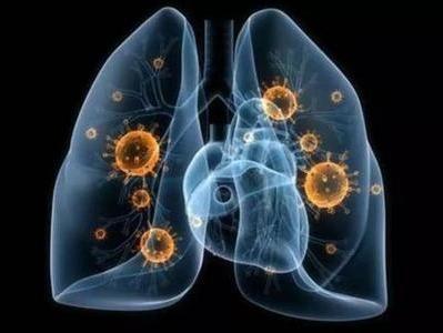 意大利最新肺炎病例数及疫情应对现状