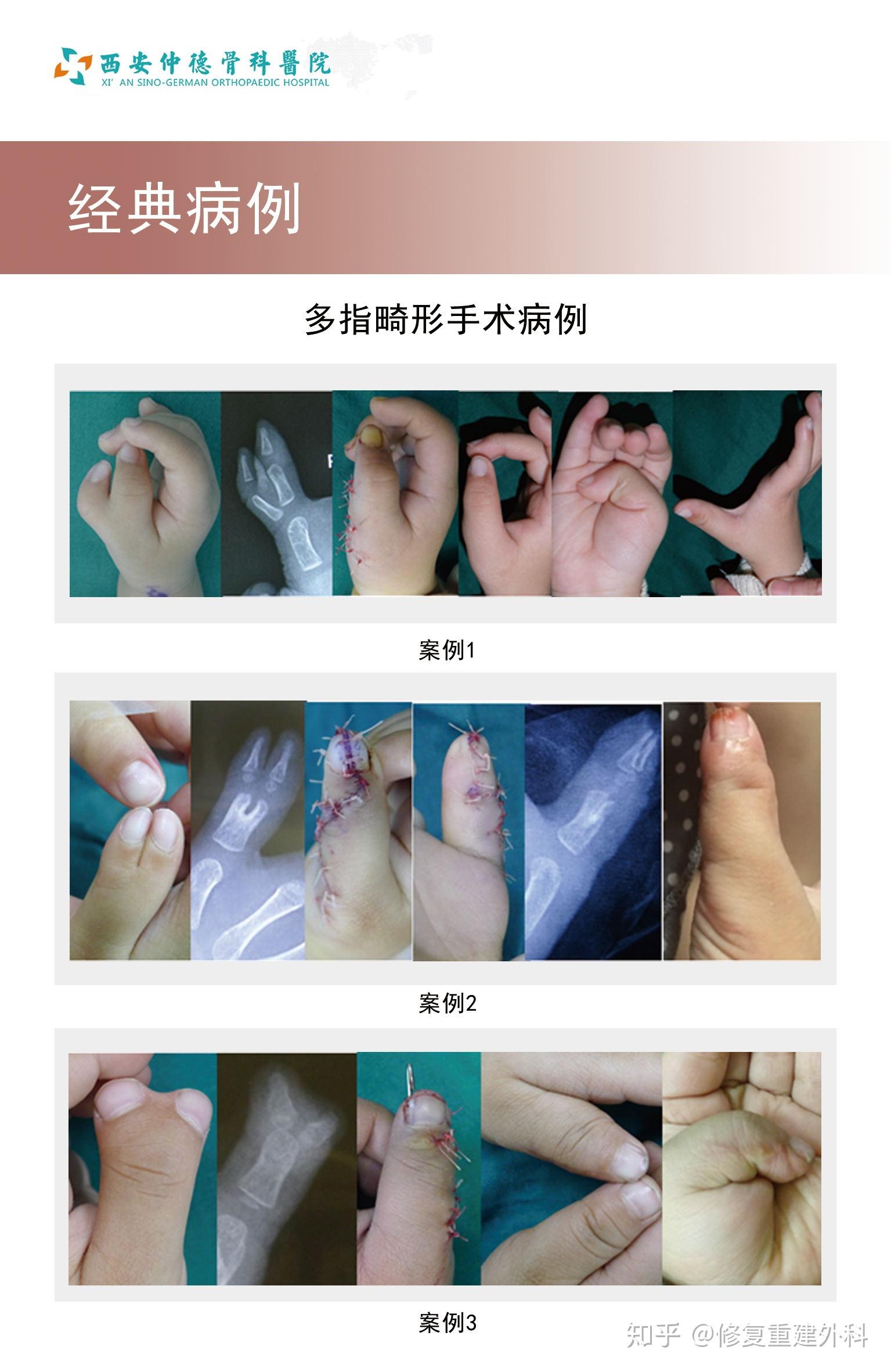 跃宸